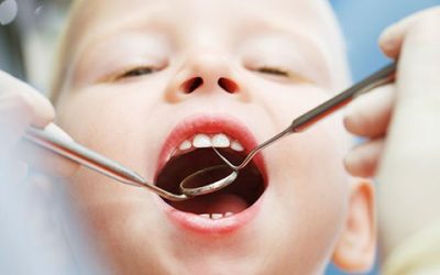 Caries afectan cerca del 90% de los escolares en el mundo, ¿Cómo prevenirlas?