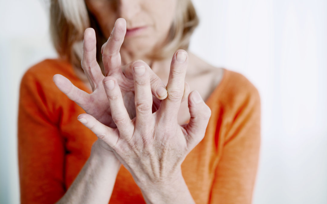 La artritis reumatoide es 2.5 veces más común en mujeres