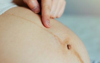 ¿Qué es esa línea oscura en el vientre de las embarazadas?