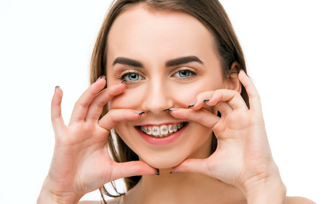 Los beneficios que brinda la ortodoncia para la salud integral en las personas