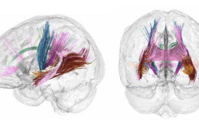 El cerebro de la mujer disminuye de tamaño durante el embarazo